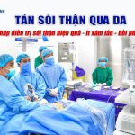 ĐIỀU TRỊ SỎI THẬN TÁI PHÁT BẰNG PHƯƠNG PHÁP TÁN SỎI QUA DA