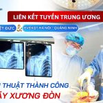 LIÊN KẾT TUYẾN TRUNG ƯƠNG – KỊP THỜI XỬ TRÍ THÀNH CÔNG BỆNH NHÂN GÃY XƯƠNG ĐÒN NGUY HIỂM DO TAI NẠN GIAO THÔNG